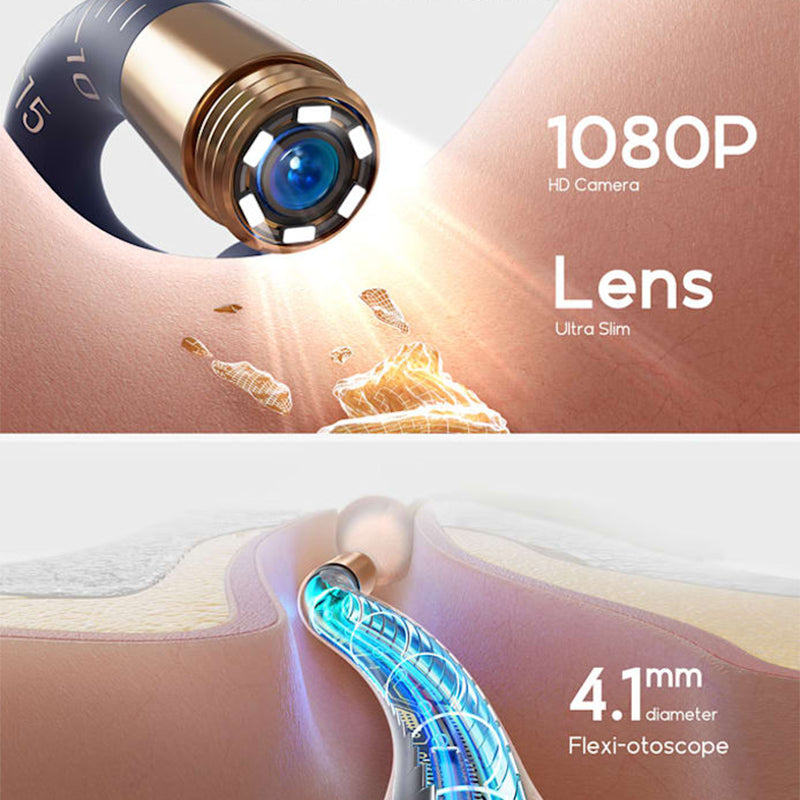 ⏳ Tidsbegränsad special⌛ Visuellt böjt kit för borttagning av öronvax
