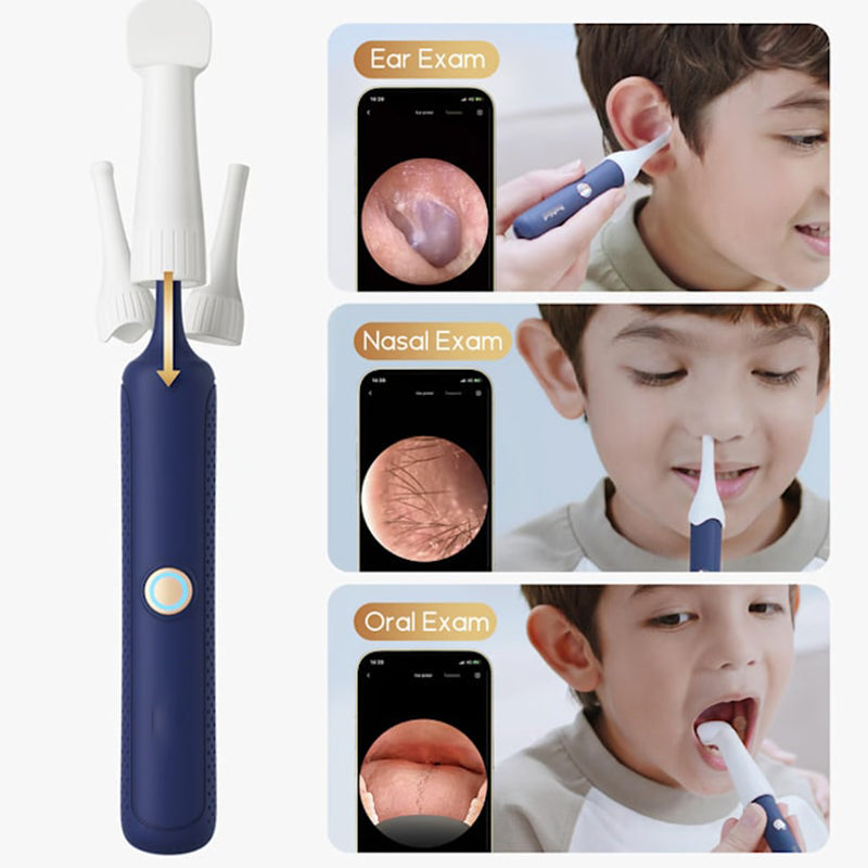 ⏳ Tidsbegränsad special⌛ Visuellt böjt kit för borttagning av öronvax